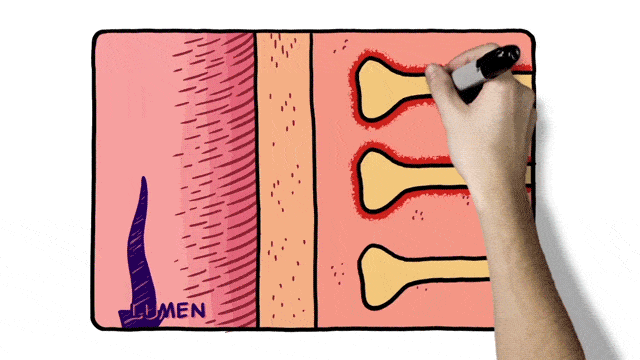 Make an Effective MOA Video: Medical...